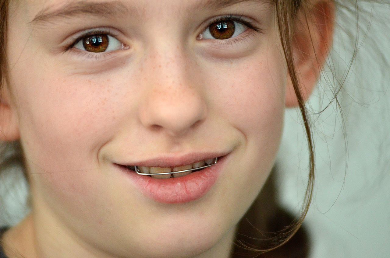 2017-05-13-Laecheln-GG-6.5 Lächeln (Foto: Günter Giese)