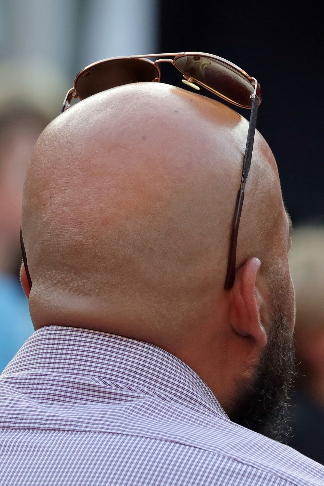 Serie: Hair 4 (Foto: Claus Gebhardt)